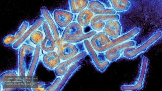 Colorized Marburg virus particles viewed with a transmission electron microscope